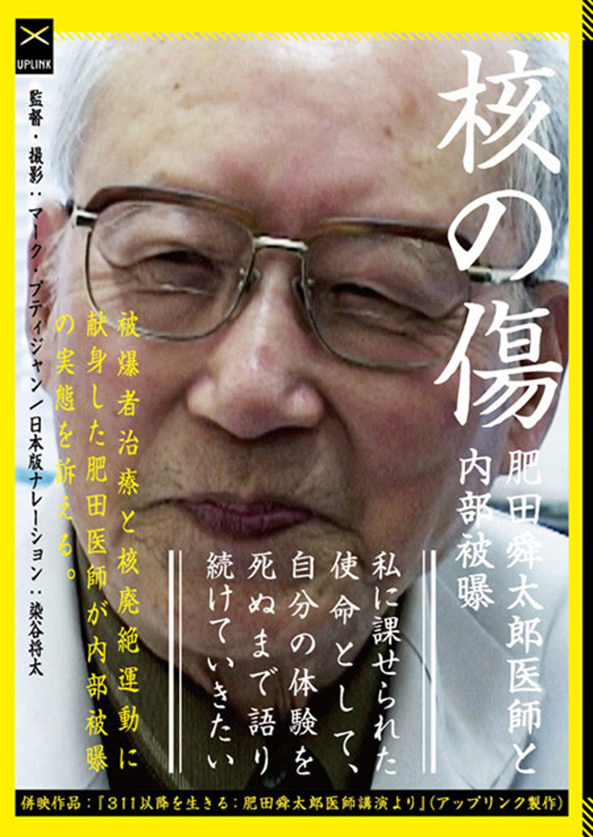 核の傷：肥田舜太郎医師と内部被曝の画像